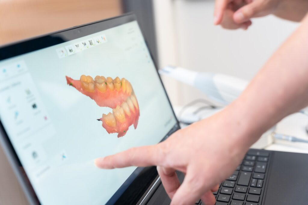 A doctor in the dental clinic explaining and looking at the 3d of the x-ray on the computer